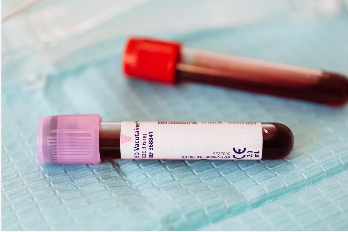 anticoagulación
