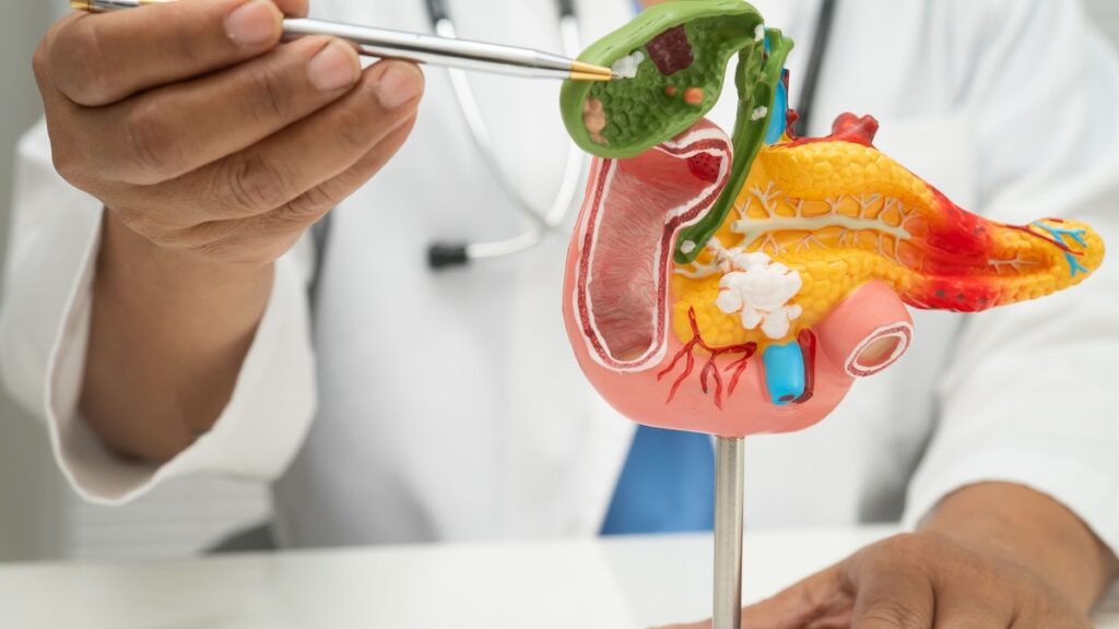 farmaco cáncer de pancreas