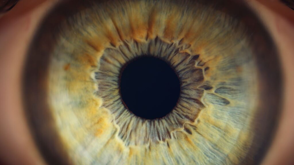 retina ia